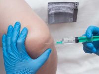 apple cider vinegar for fluid retention in legs