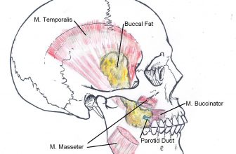 Buccal Fat Removal
